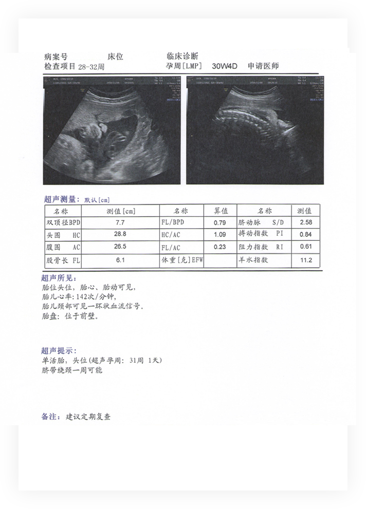 2,具體檢查範圍 進一步觀察胎兒各臟器發育情況,根據雙頂徑(bpd)